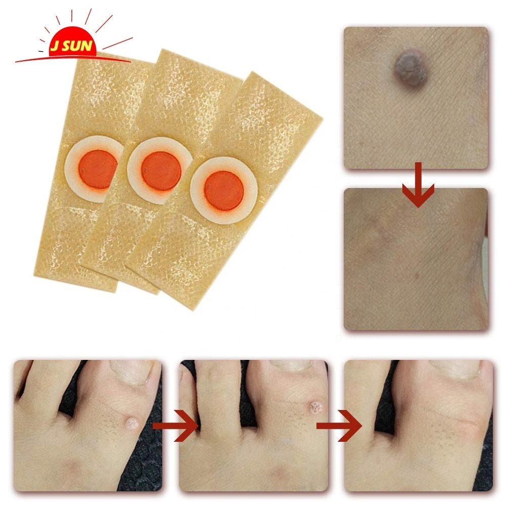 Corn Remover Pads, Toe Corn and Callus Removal Best Corn Remover Eyelet Plaster Pads