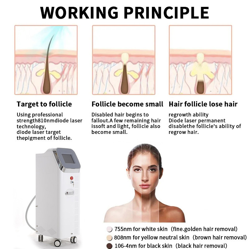 2024 New hair removal machine beauty equipment Professional laser light hair removal machine for sale