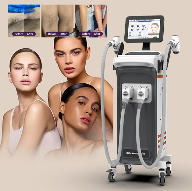 Newest 4 wavelength 755nm 1064nm 808nm 940nm professional ice painless diode laser hair removal machine