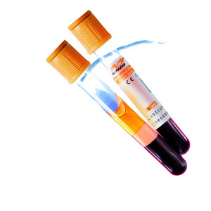 Gel & clot activator tube