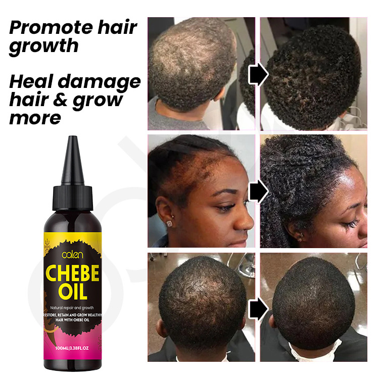 Oalen Private Label 100% Natural Hair Care Hair Loss Treatment Promote Hair Growth Chebe Oil