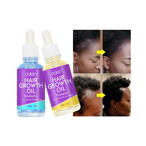 Wholesale Private label Organic Pineapple Hair Growth Oil For All Hair Types