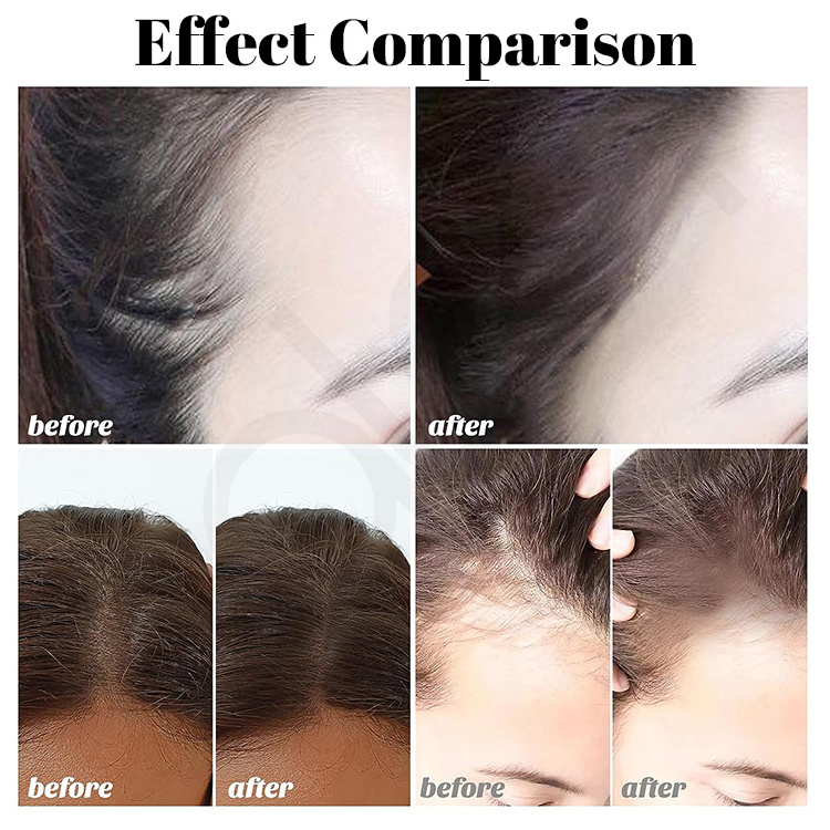 Luxfume Private Label Instantly Conceals Hair Loss Color Hair Root Touch Up Powder