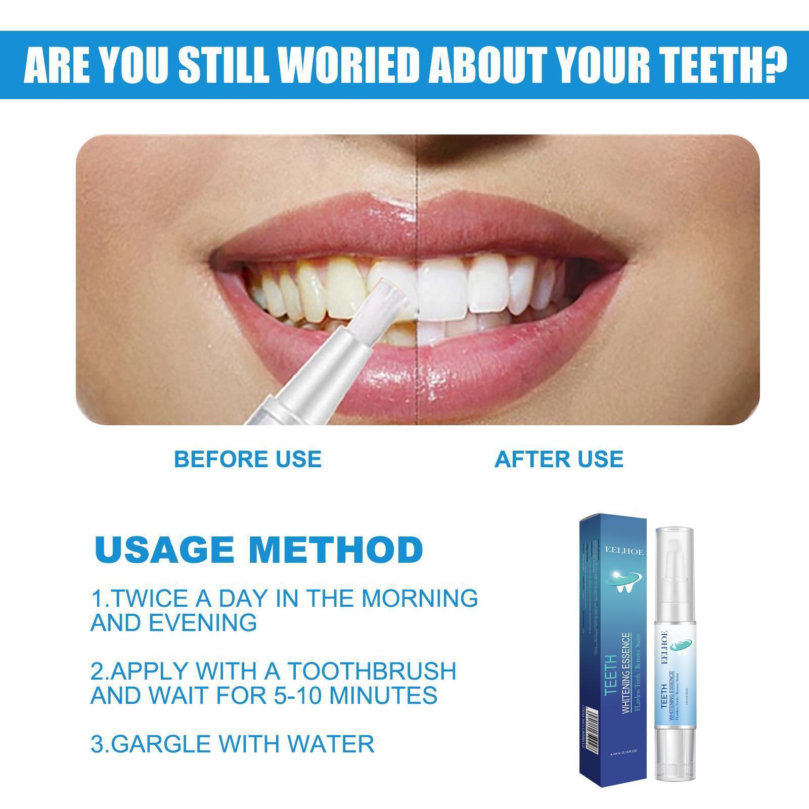 Teeth Whitening Manufacturer Custom Logo Peroxide 4ml Instant Whitening Gel White Teeth Whitening Pen Advanced Formula