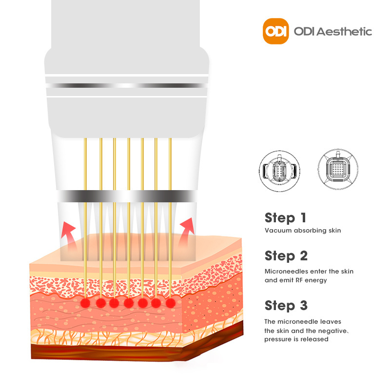 Korea Beauty Machine Microneedle Rf Machine Fractional 10/25/64 Needle  Rf Microneedling Machine