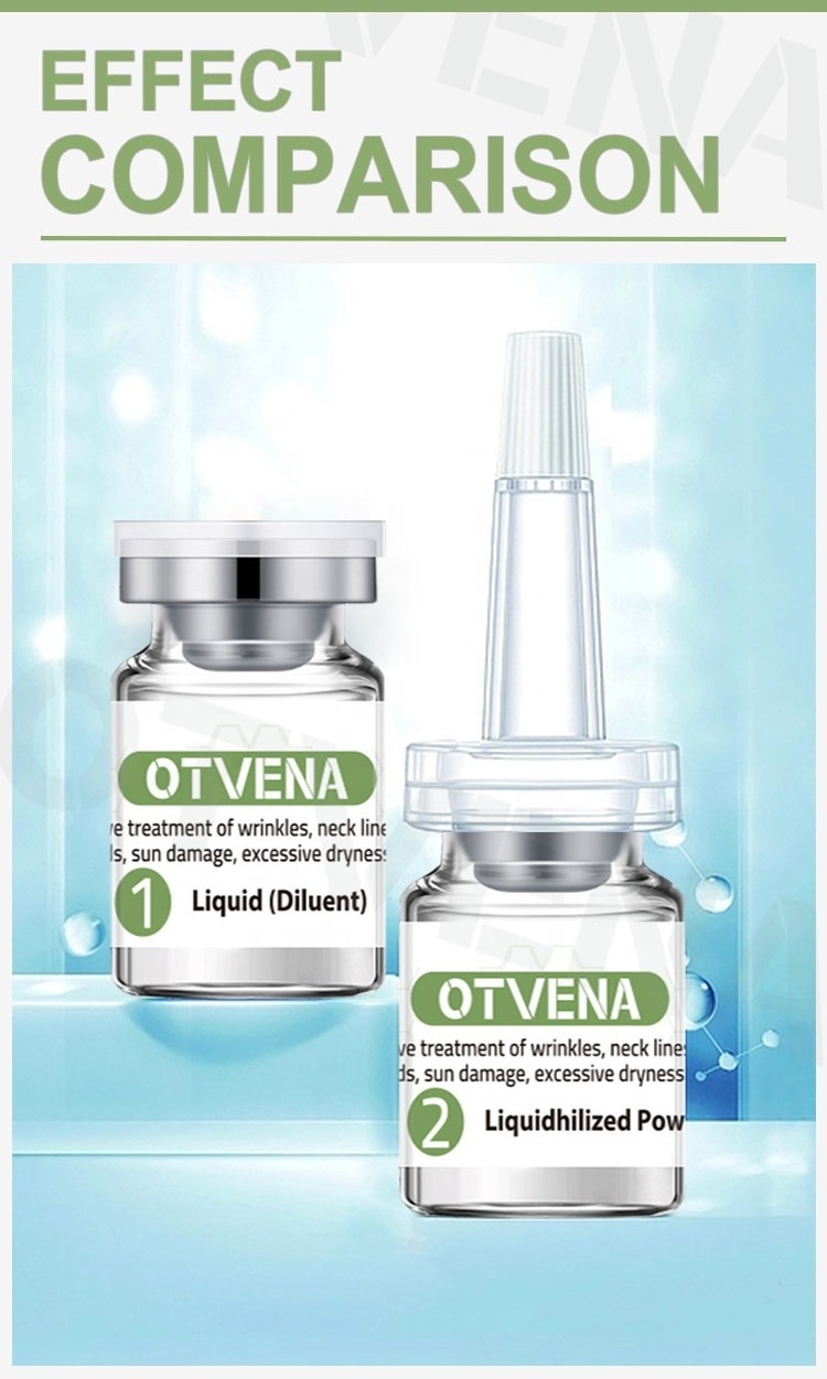 OTVENA NEW coming Lyophilized Powderey for acne removal anti wrinkle products