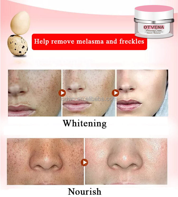 OTVENA extra whitening cream vagina pink whitening cream make your own brand