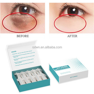 OTVENA  peptide Instant anti wrinkle  remove eye bags dark circle firming Lifting Age less eye cream