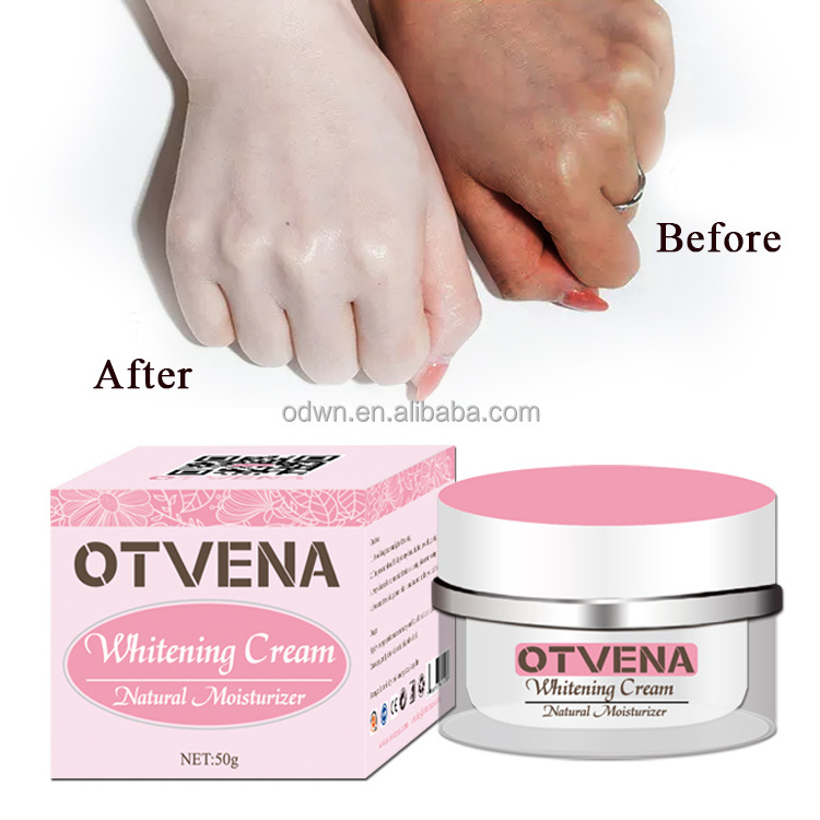 Hot Selling skin whitening lightening bleaching Strong Bleaching Cream For Skin