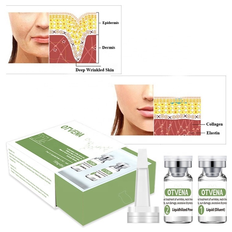 OTVENA NEW coming Lyophilized Powderey for acne removal anti wrinkle products