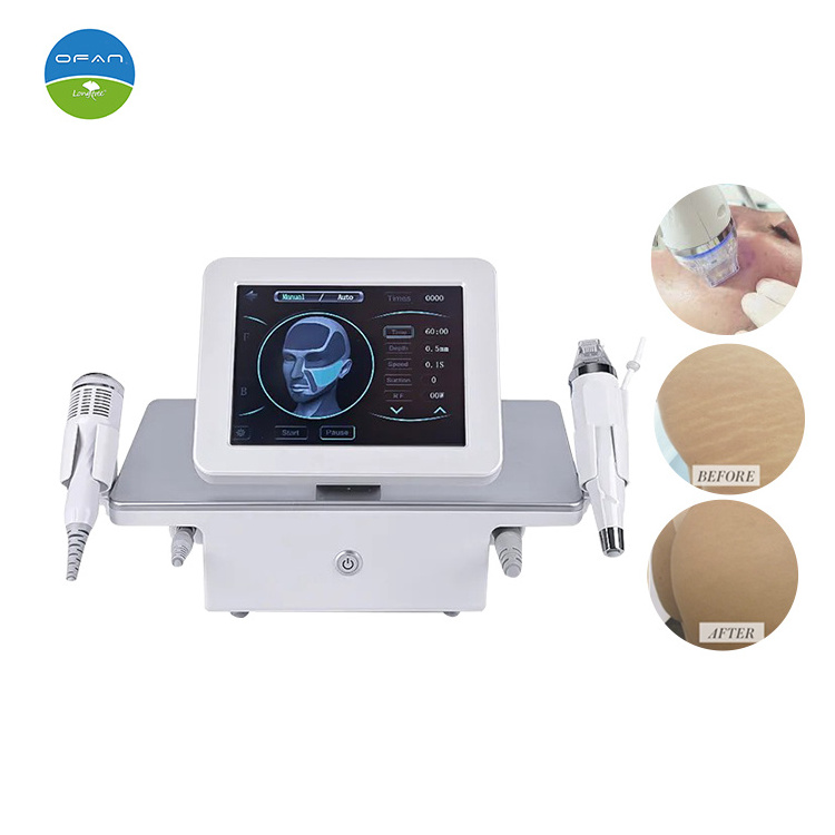 OFAN vivace anti wrinkle remover device stretch mark removal face lift rf microneedle microneedling machine