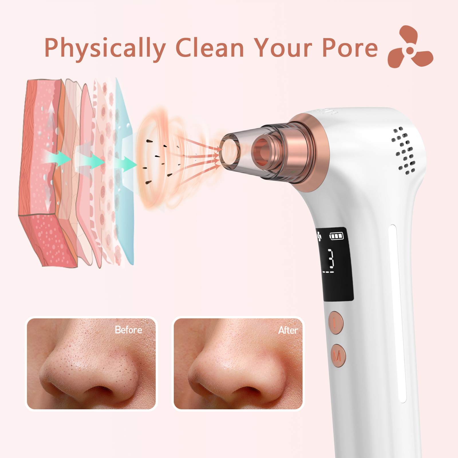 New Electric  Skin Care Pimple Pore Strips Blackhead Remover Vacuum Device Remove Blackheads Whiteheads Removal Extractor