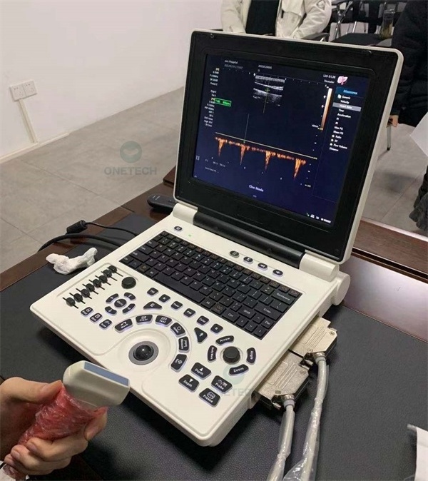 C55 Portable Laptop ultrasound machine price, 3D high frequency ultrasound linear probe for big sale