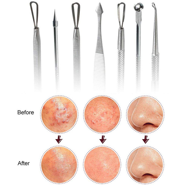 Pimple Popper Tool Kit Blackhead Remover Acne Removal Comedone Extractor Kit