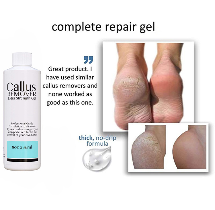 Foot Care Gel Exfoliator Formula With Tea Tree Oil & Lemon Scent Callus Remover For Feet