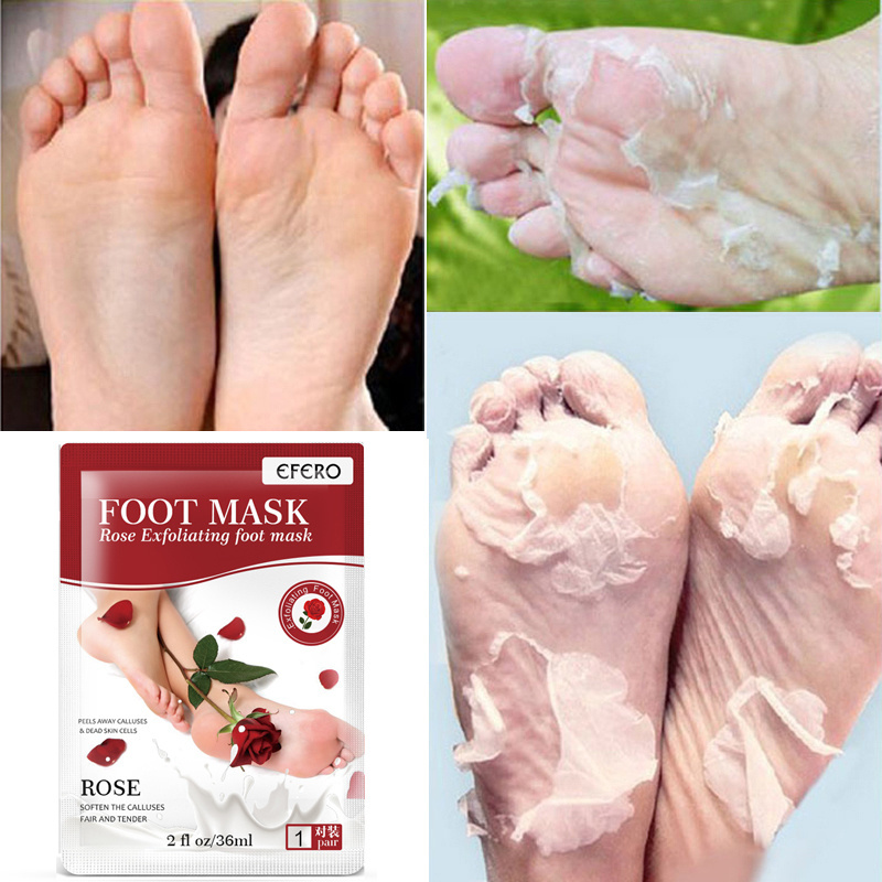 Benen Peel Off Heel Foot Care Patch Tslm2 Oem Rose Hakken Verwijderen Dode Huid Pedicure Peeling Ontgiften Voeten Masker Adults