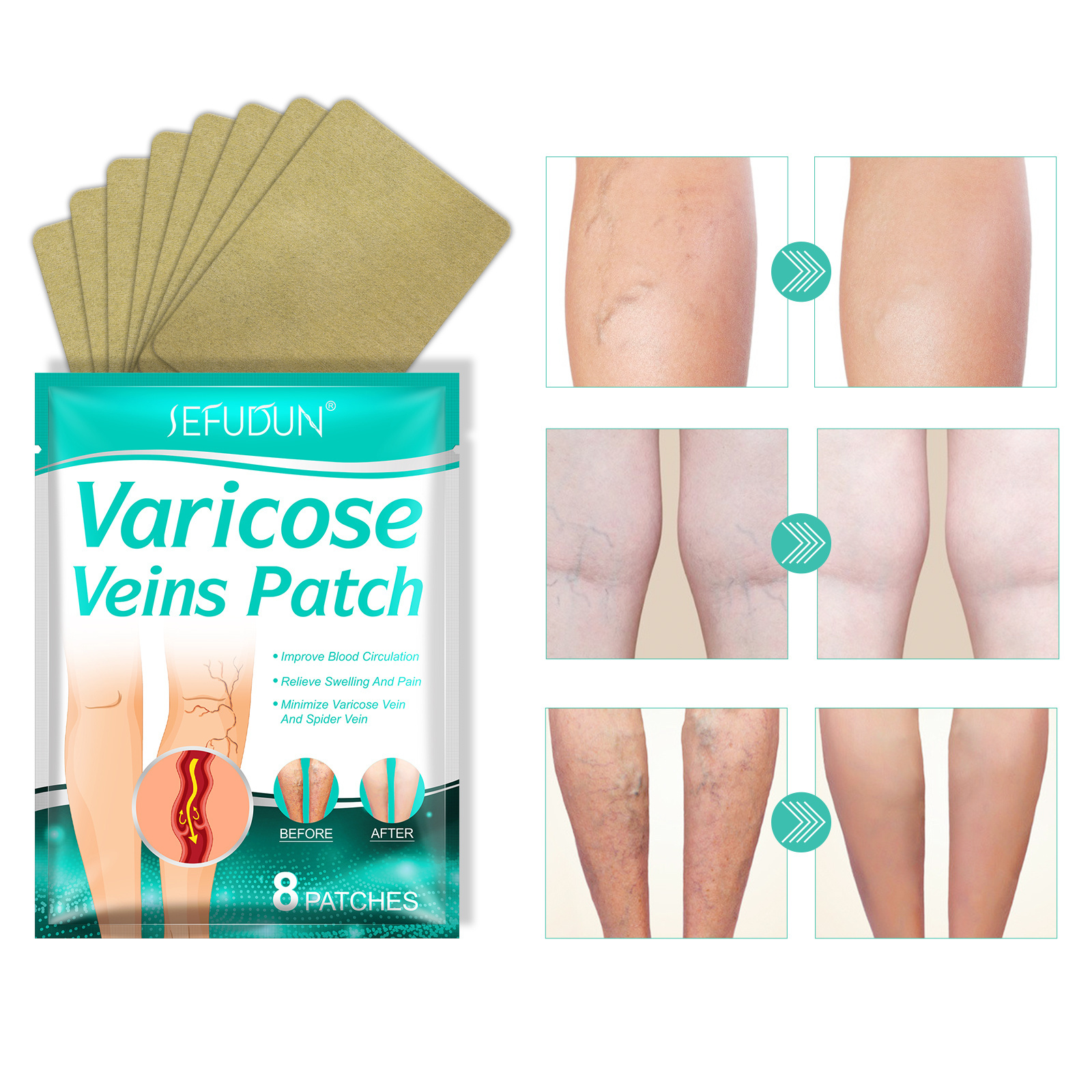 OEM Relief Leg Pain Strengthens Capillary Health Improve Blood Circulation Varicose Veins Patch