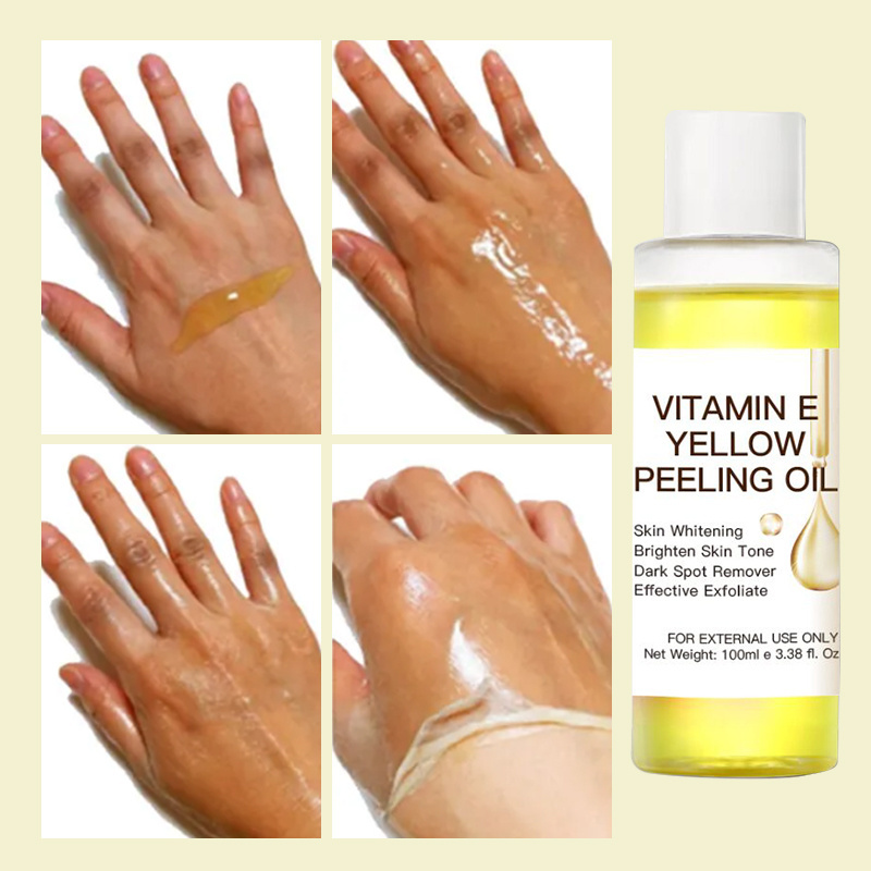 Oem Private Label Organic Remove Dead Skin Exfoliating Whitening Yellow Peeling Oil