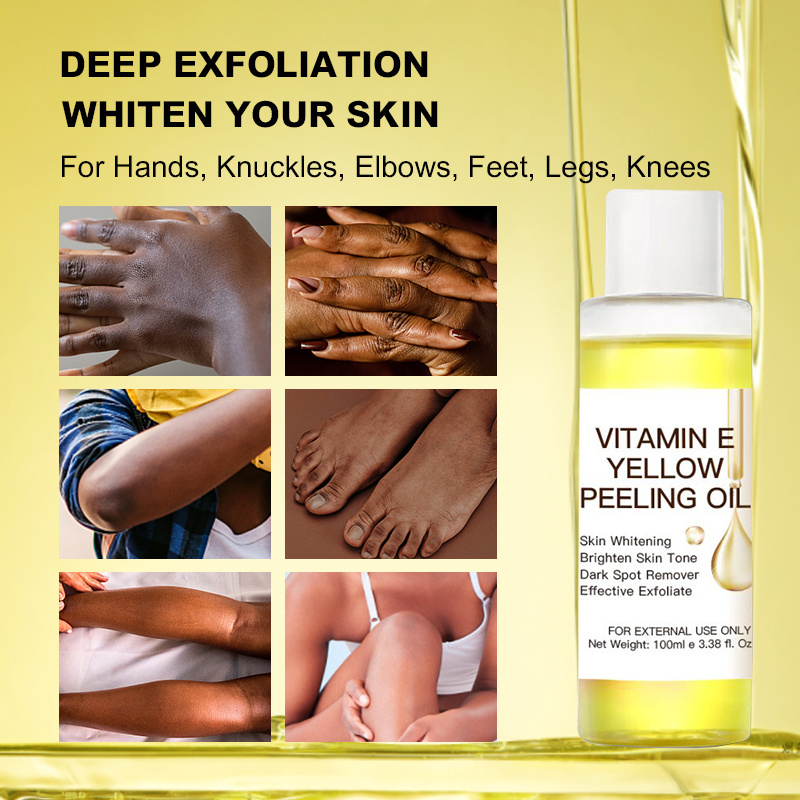 Oem Private Label Organic Remove Dead Skin Exfoliating Whitening Yellow Peeling Oil