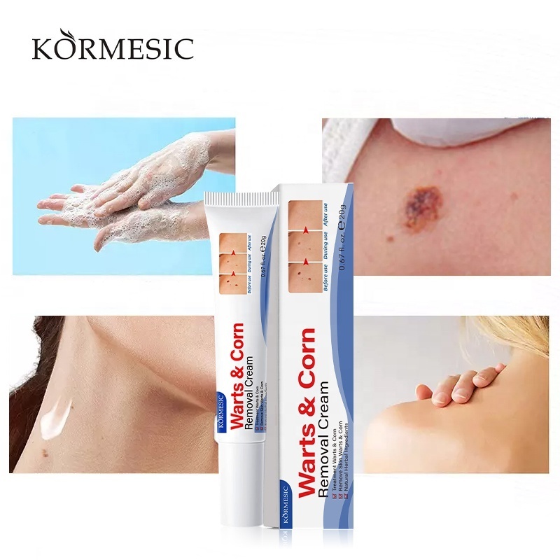 KORMESIC Warts and corns removal cream  Face Acne Scar Pimples Dark Spot Remover Anti Acne