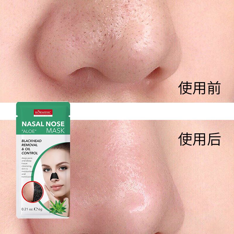 OEM private label bamboo charcoal Remove Blackheads Acne Nose Pore Strips Deep Cleansing Nose Acne Mask Strips Nose Pore Strips