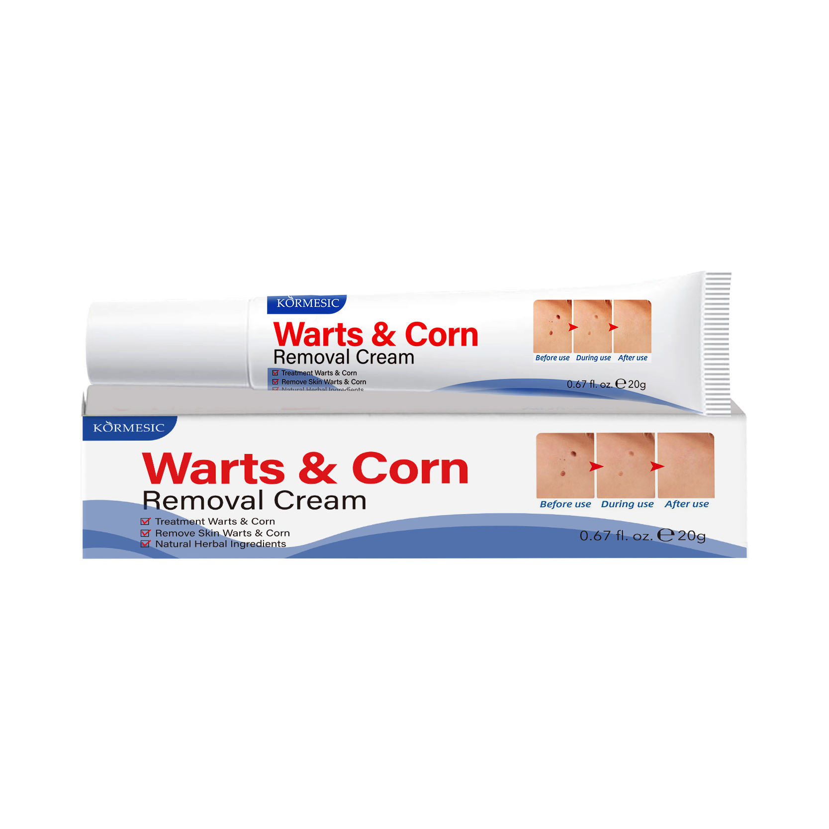 KORMESIC Warts and corns removal cream  Face Acne Scar Pimples Dark Spot Remover Anti Acne