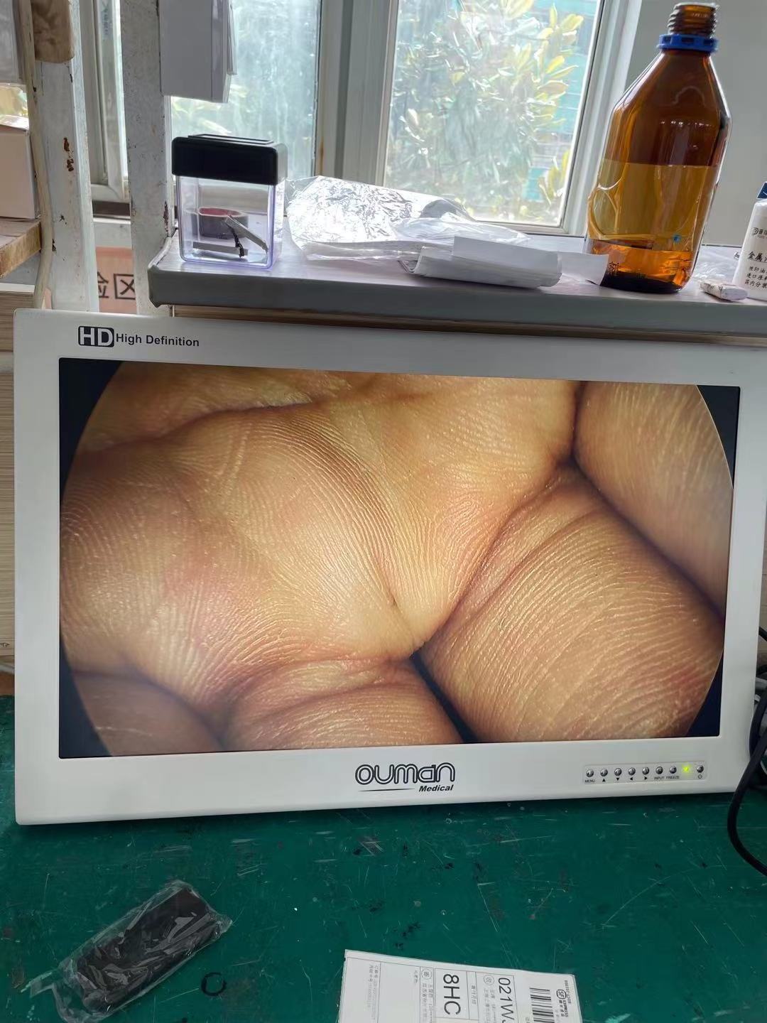 Urology surgical 24 inch 27 inch medical grade monitor