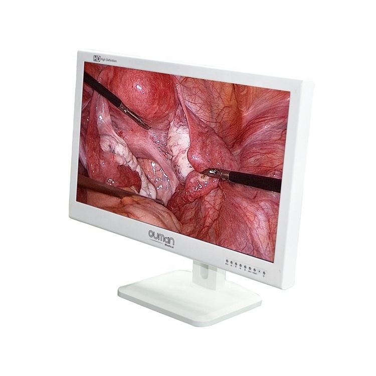 LED screen laparoscopy surgery medical grade monitor