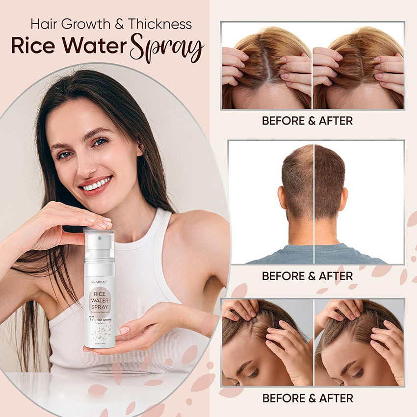 OEM Private Label Bestselling Hair Repair Regrowth Biotin Rice Water Spray Hair growth Serum Caffeine Hair Regrowth Spray