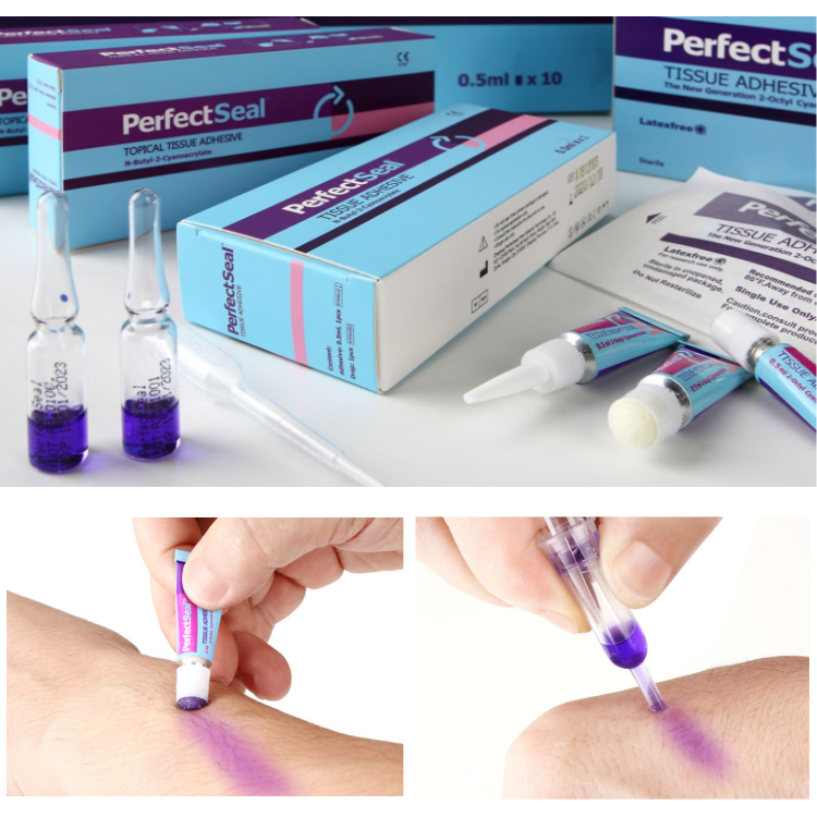 Topical Tissue Adhesive Medical Super Glue for Cuts