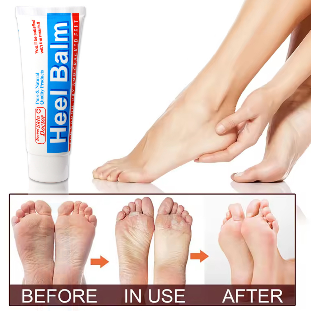 Foot Skin Care Product Softens Moisturizes Healthy Foot Cream 25% Urea Dry Cracked Feet Cracked Heel Repair Heel Stick Foot Balm