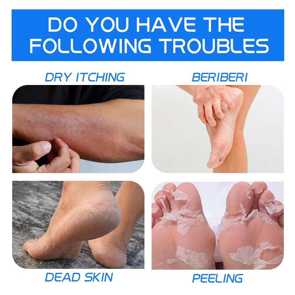 Foot Skin Care Product Softens Moisturizes Healthy Foot Cream 25% Urea Dry Cracked Feet Cracked Heel Repair Heel Stick Foot Balm