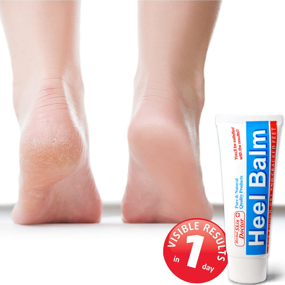 Foot Skin Care Product Softens Moisturizes Healthy Foot Cream 25% Urea Dry Cracked Feet Cracked Heel Repair Heel Stick Foot Balm