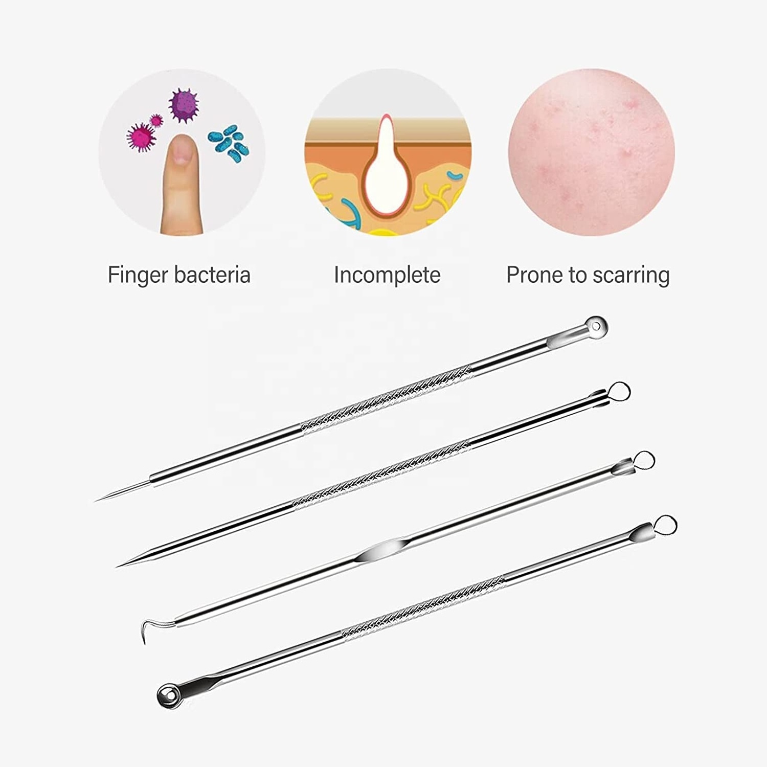 Blackhead Removal Tool Pimple Popper Extractor Tool Kit Used for Removing Blackheads Acne Comedone Flaw White Heads on Nose