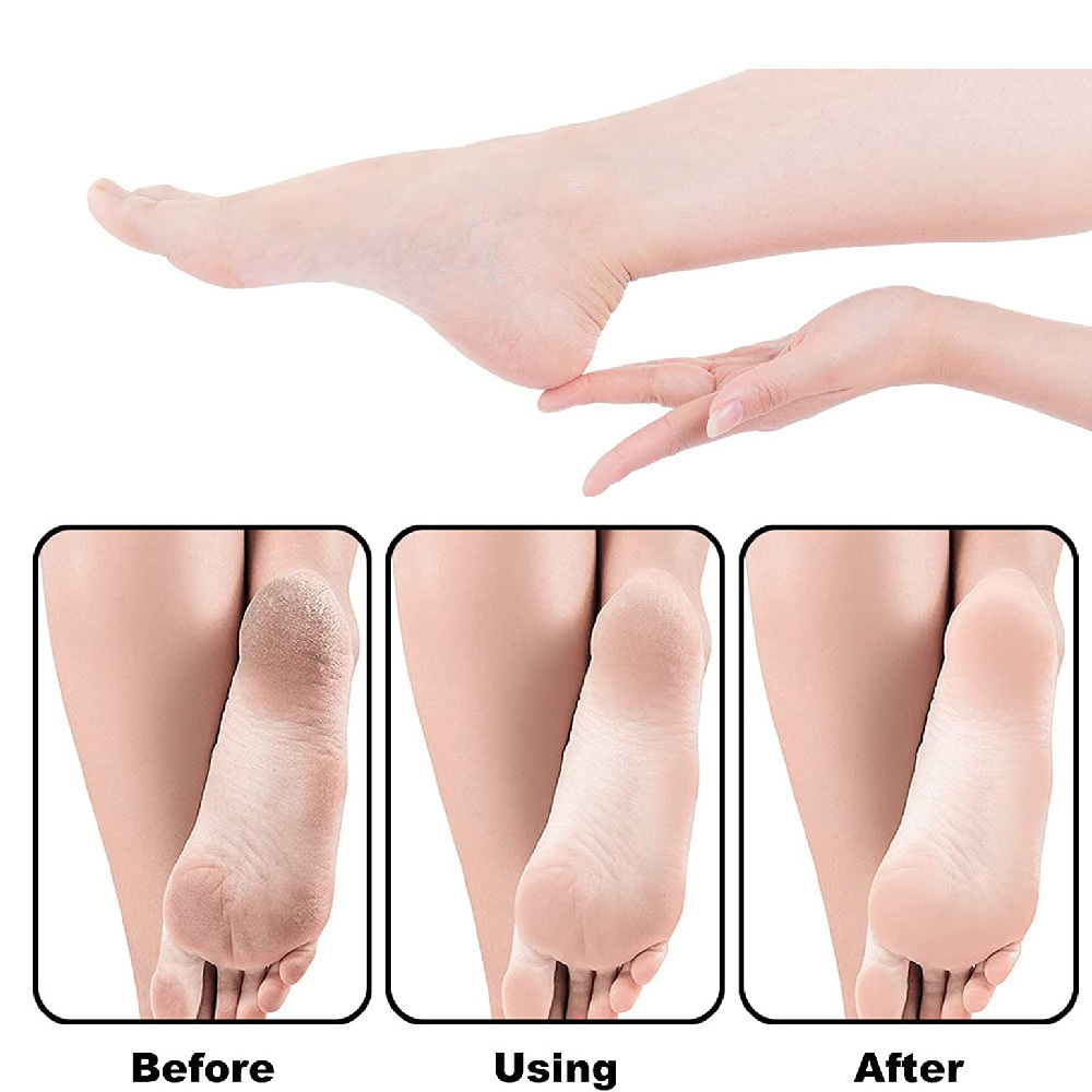 Professional Foot Scrubber for Hard Skin Premium Pedicure Foot File Foot Scraper Callus Remover for Feet Leaving Soft