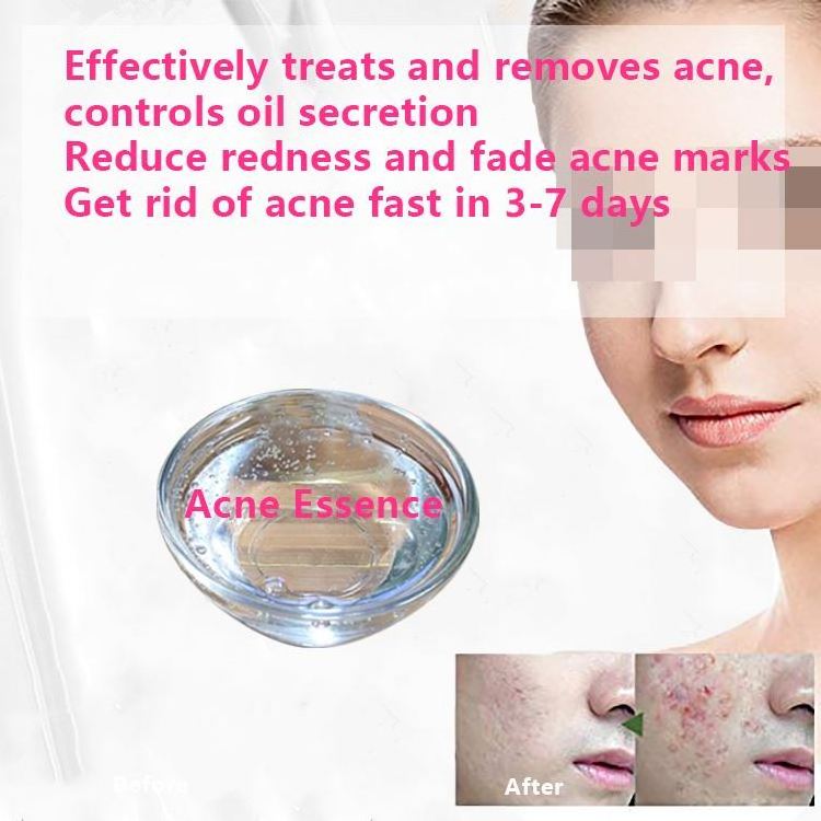 New Product Original Liquid VC Remove Acne Scars Bio Serum