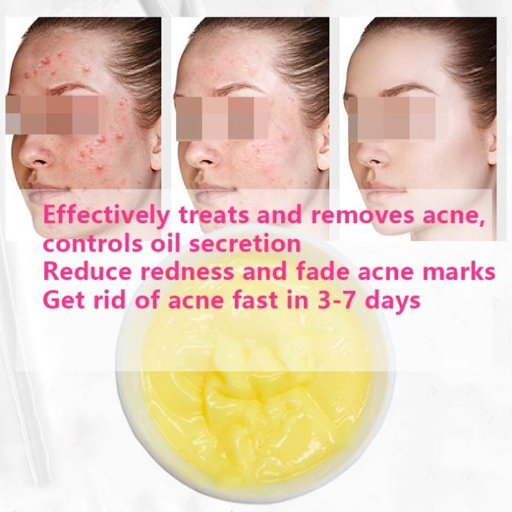 New Arrival Whitening Anti Wrinkle Bye Blemish Remove Acne Scars Bio Essence