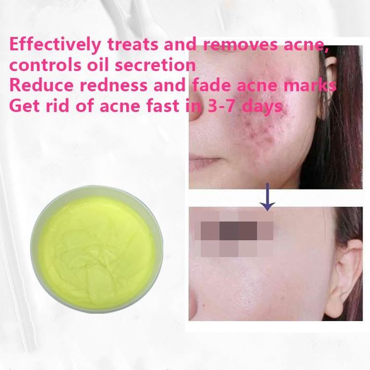 Hot Sell Original Liquid VC Remove Acne Scars Bio Serum