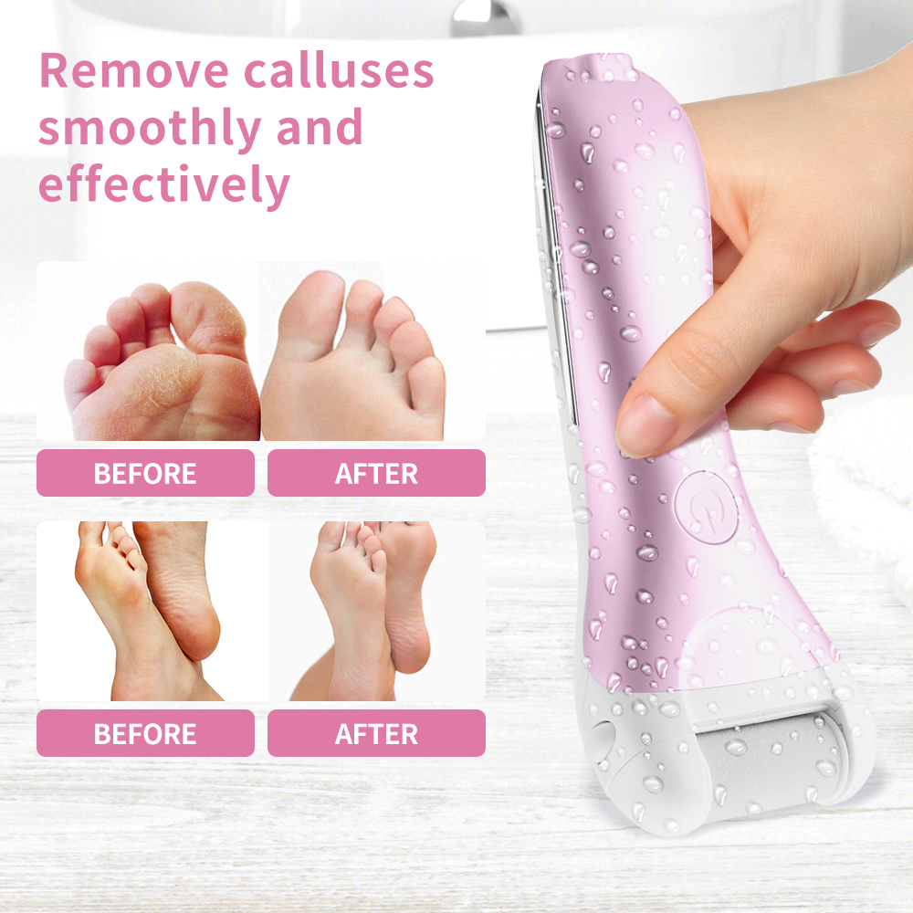 PRITECH IPX4 Waterproof Foot File Callous Remover USB Rechargeable Electric Callus Remover