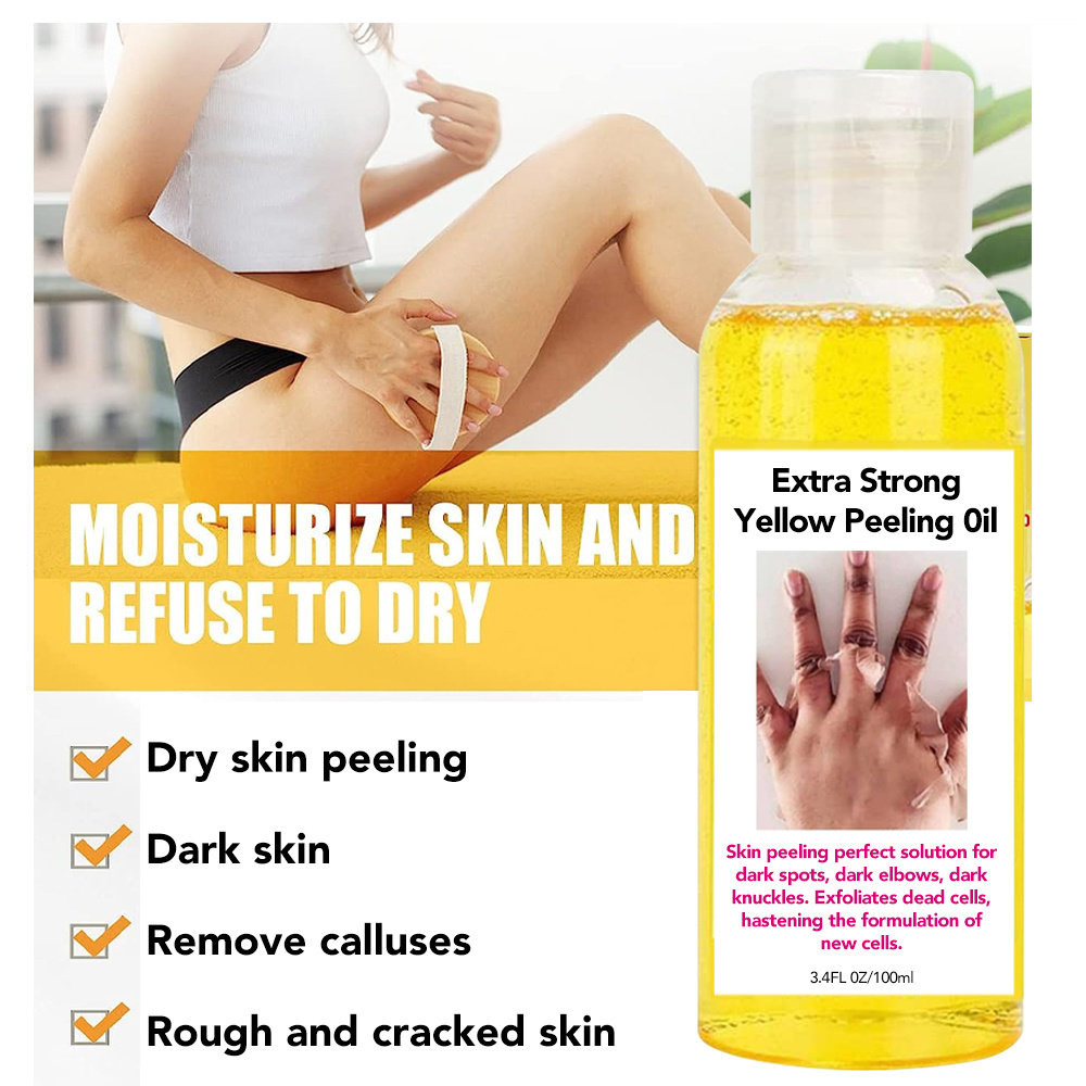 Private Label Skin Whitening Dead Skin Remover Dark Exfoliating Extra Strong Peeling Oil Yellow Peeling Oil For Face And Body