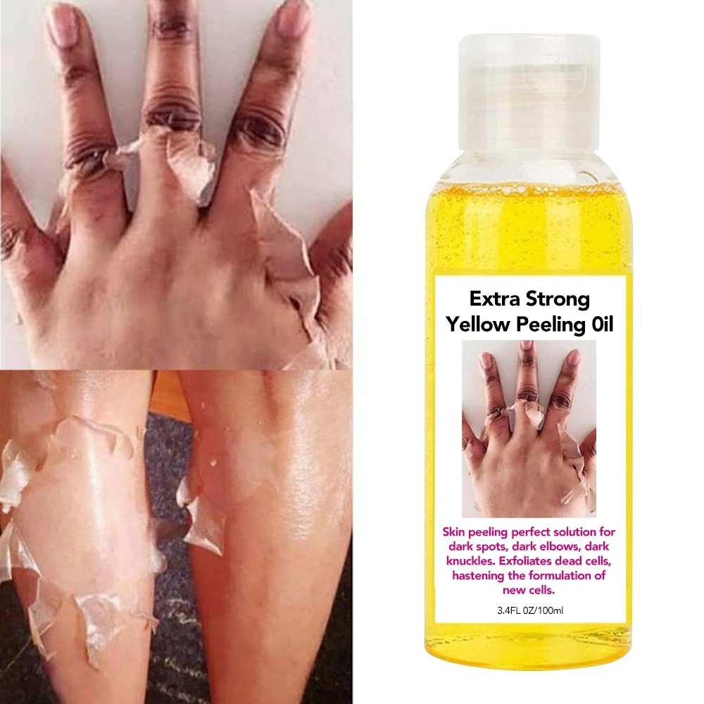 Lightening Extra Peeling Oil Orange Yellow Peeling Oil Whitening Yellow Peeling Oil