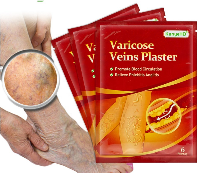 Chinese Herbal Medical Varicose Veins Patch Plaster knee Arthritis Joint muscle Pain Relief Patch