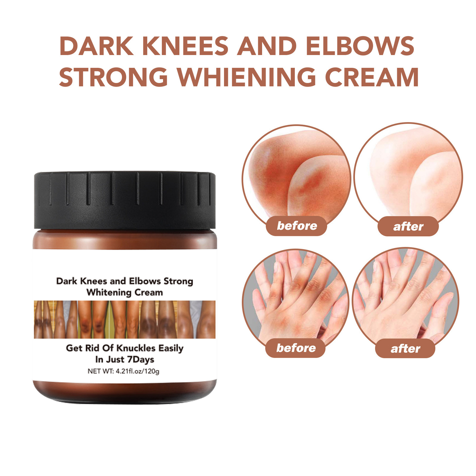 wholesale bleaching cream papaya under arm 7 days black dark inner thigh skin care whitening creams without side effects