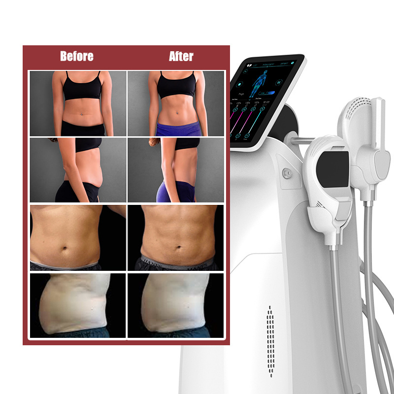 UMS Sculptor Professional Rf Ems Body Sculpting Machine Neo Ems Muscle Building Machine Em Slim Machine