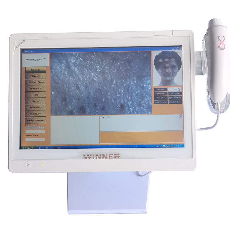 Wholesale low price visia skin analysis machine for sale