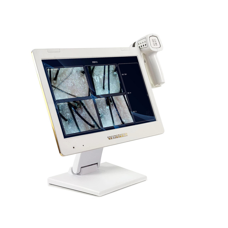 Wholesale low price visia skin analysis machine for sale