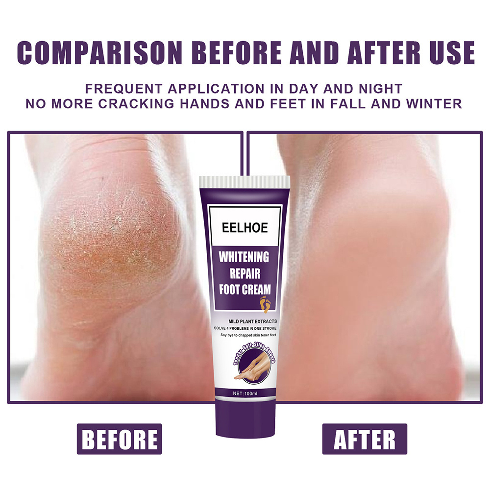 Wholesale Heel Balm Rich Moisturizing & Exfoliating Wholesale Dry Feet Repair Cream Heal Foot Callus Dead Skin Removal Gel Cream