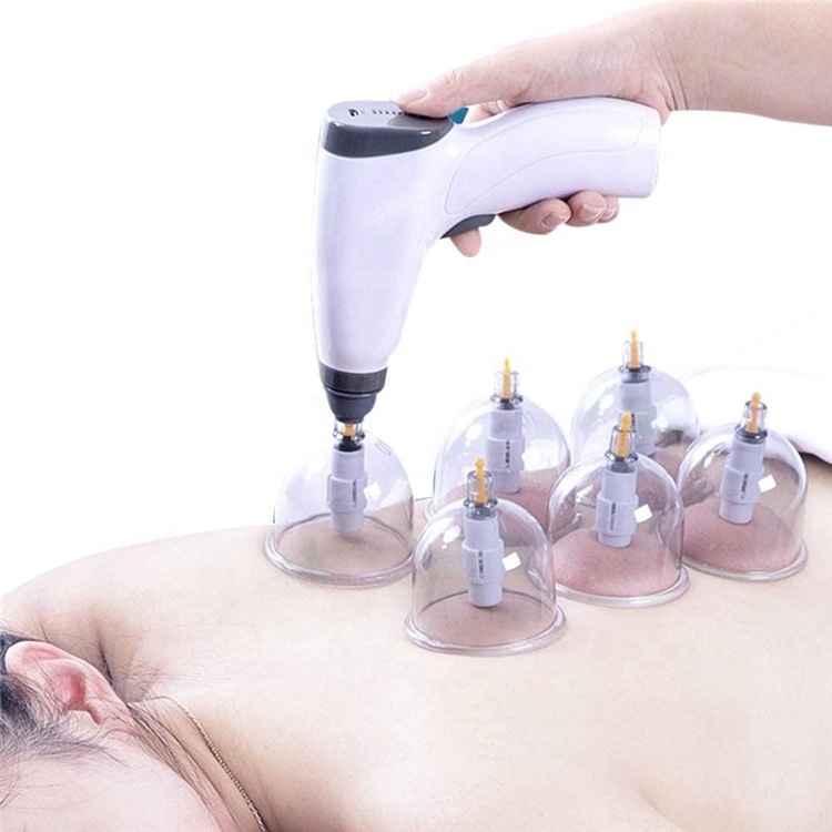 Chinese Traditional  USB Charge Electric cupping pump Cupping Device Pump Mini Suction Vacuum Cupping Machine