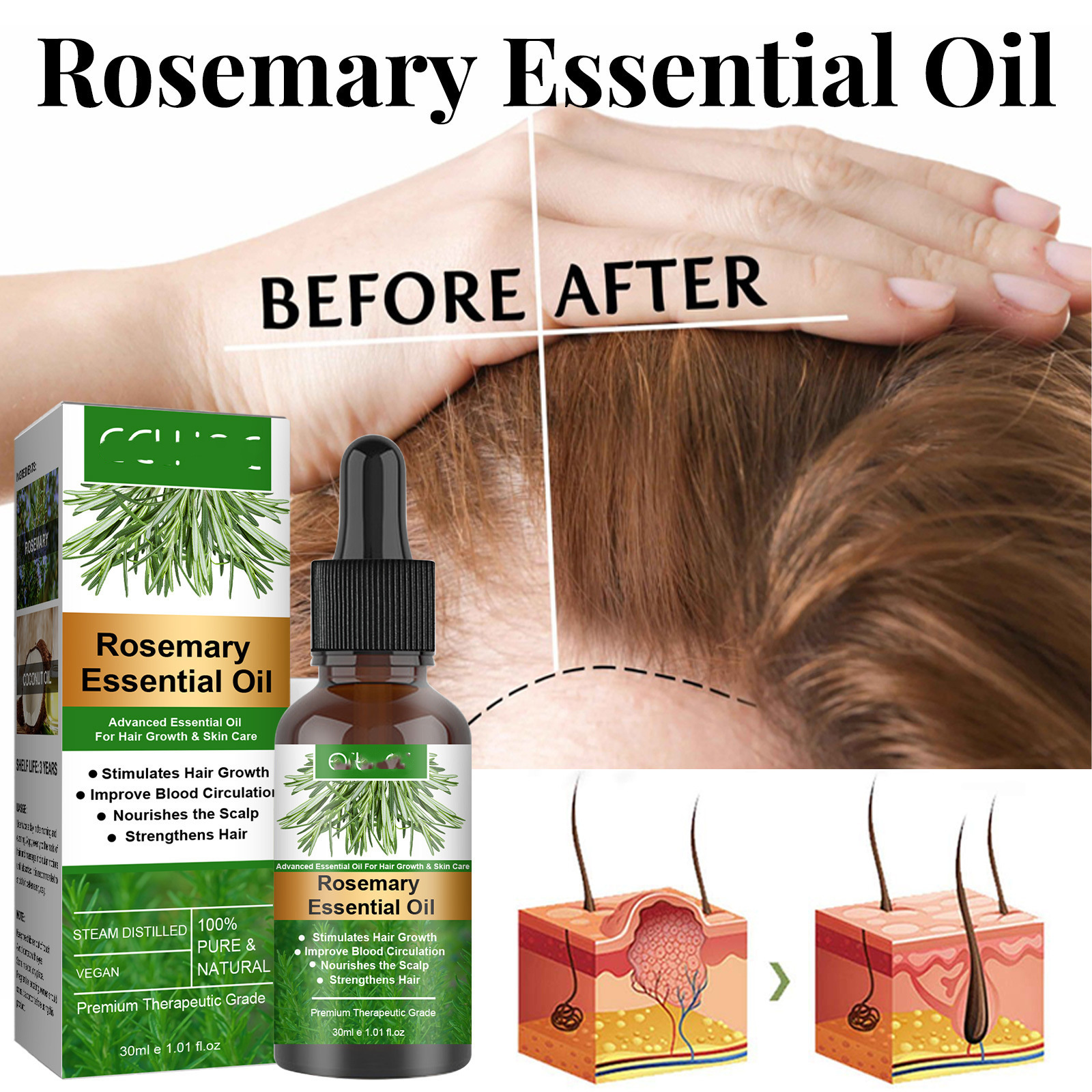 Rosemary Essential Oil Serum For Black Women Private Label Hair Treatment Oil For Bald Hair Growth Oil Product