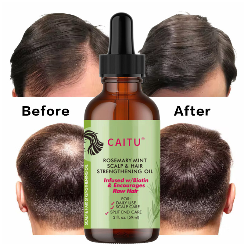 Popular Product Organic Hair Loss Treatment Rosemary Oil Hair Growth Scalp Massage Oil